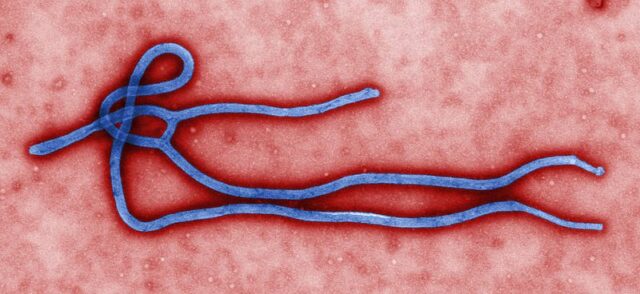 Ebola-virus-virion